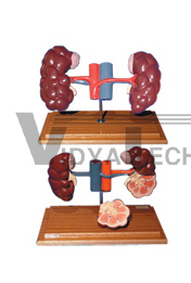 The dissection model of cattle kidneyl(2parts)